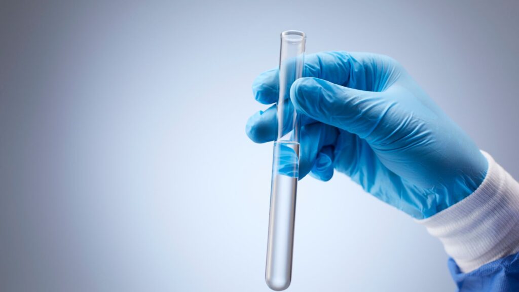 Alcohol and Drug Testing for Drivers